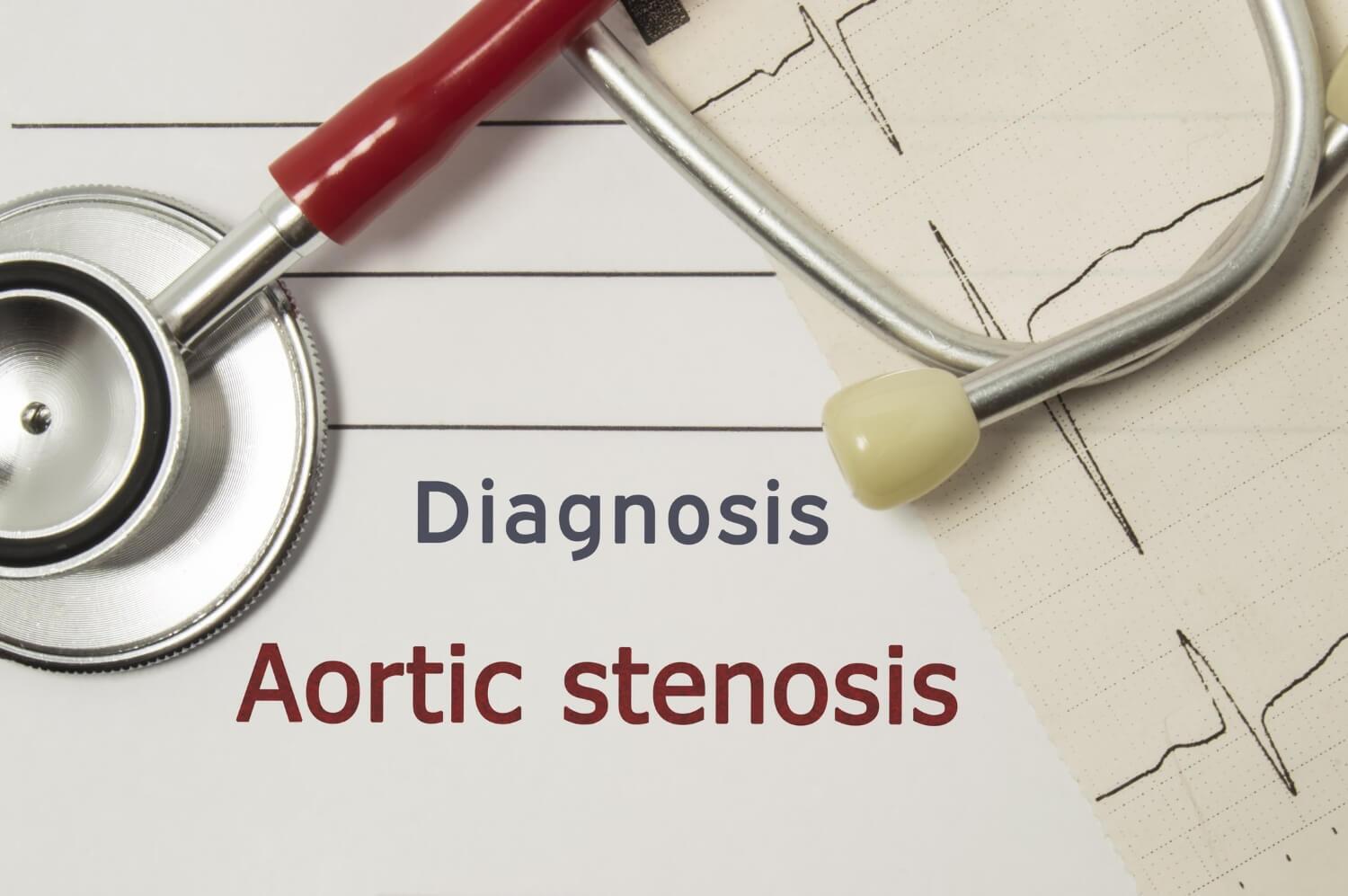 Cardiac diagnosis