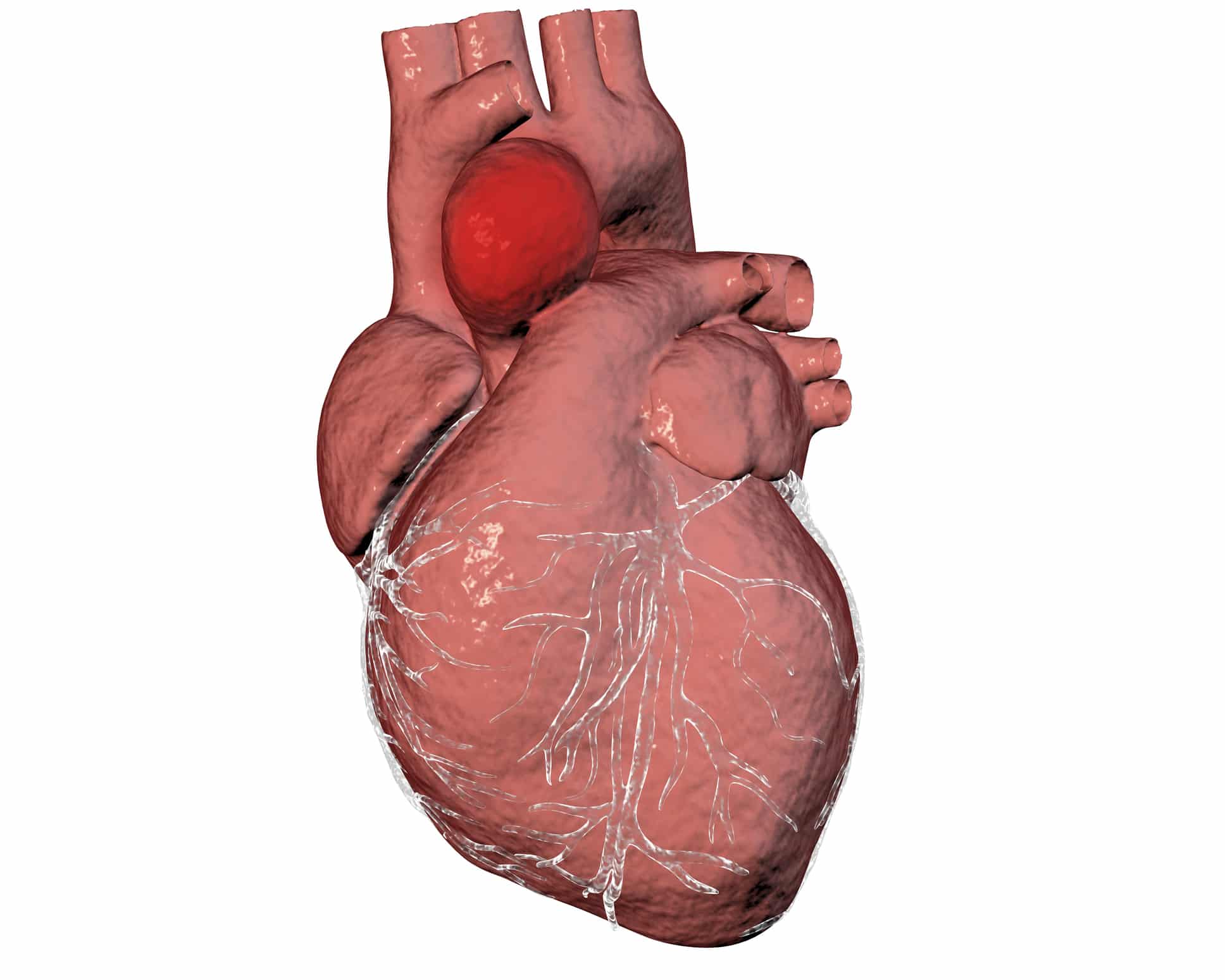 ascending aorta