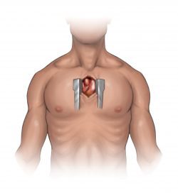 Open chest