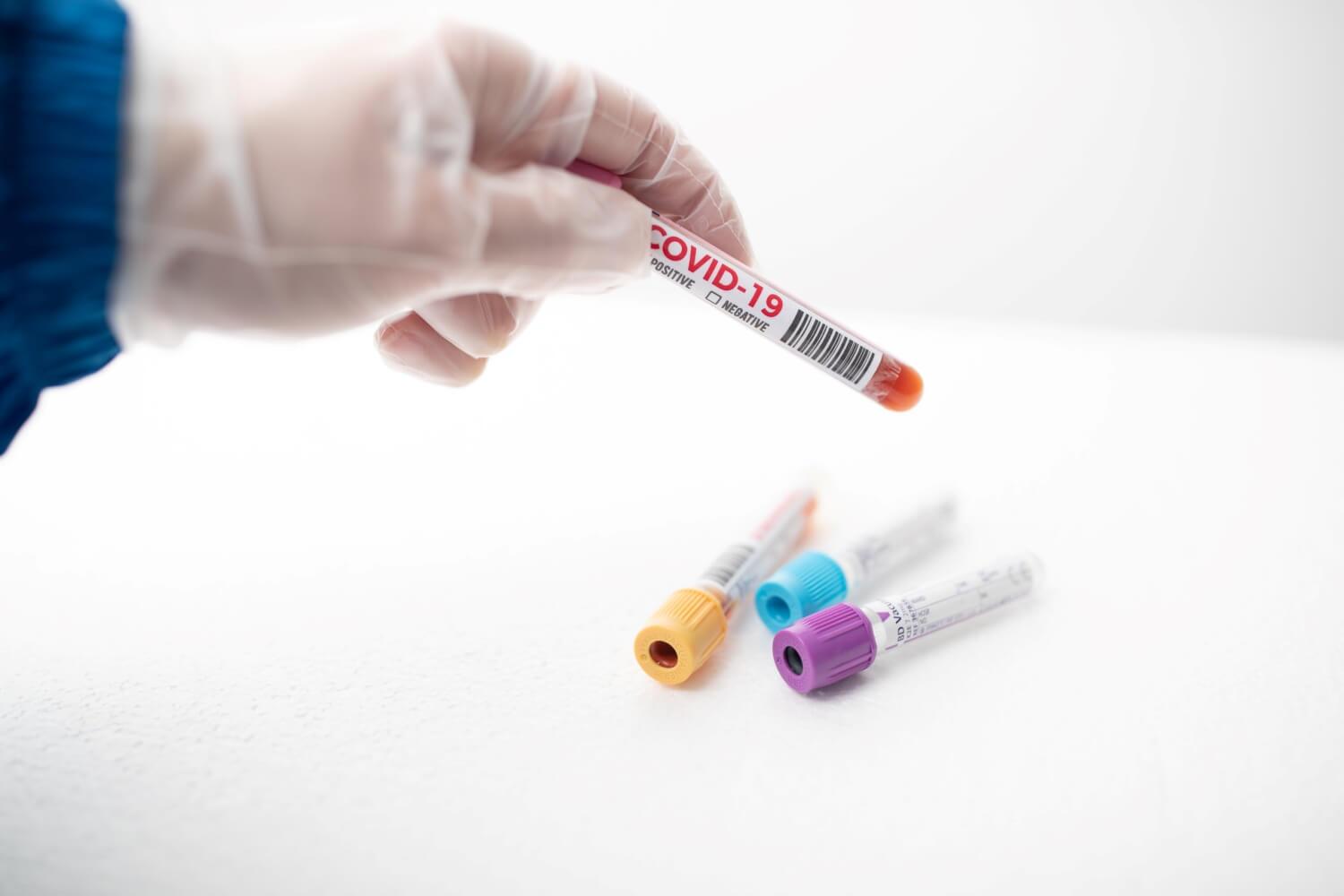 Coronavirus test